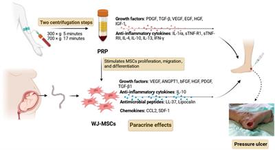 Combined treatment of umbilical cord Wharton’s jelly-derived mesenchymal stem cells and platelet-rich plasma for a surgical patient with hospital-acquired pressure ulcer: a case report and literature review